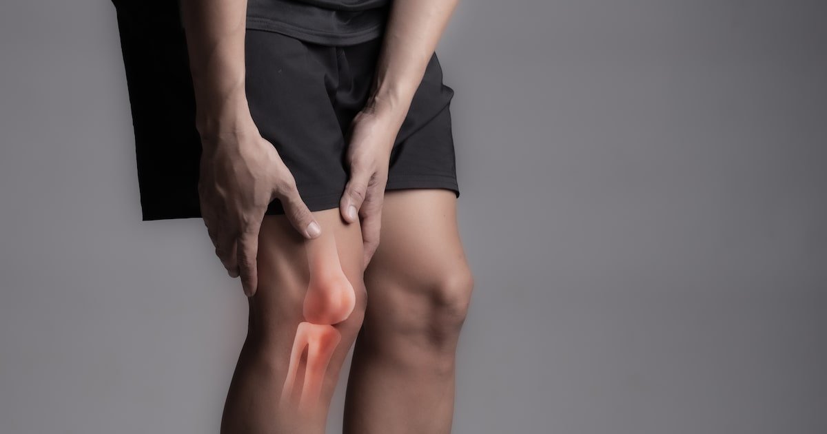 Musculação é aliada contra a artrose; saiba quais cuidados adotar antes de iniciar