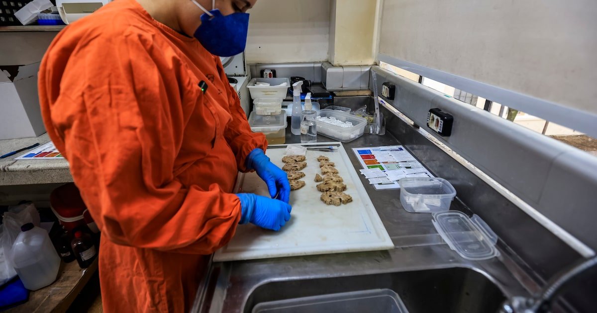Como cérebros doados em SP ajudam a desvendar as características da demência no Brasil