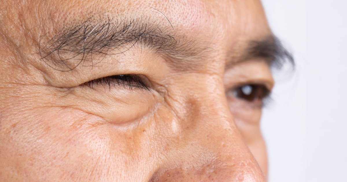 Tremor nas pálpebras: o que isso significa? É preciso se preocupar?