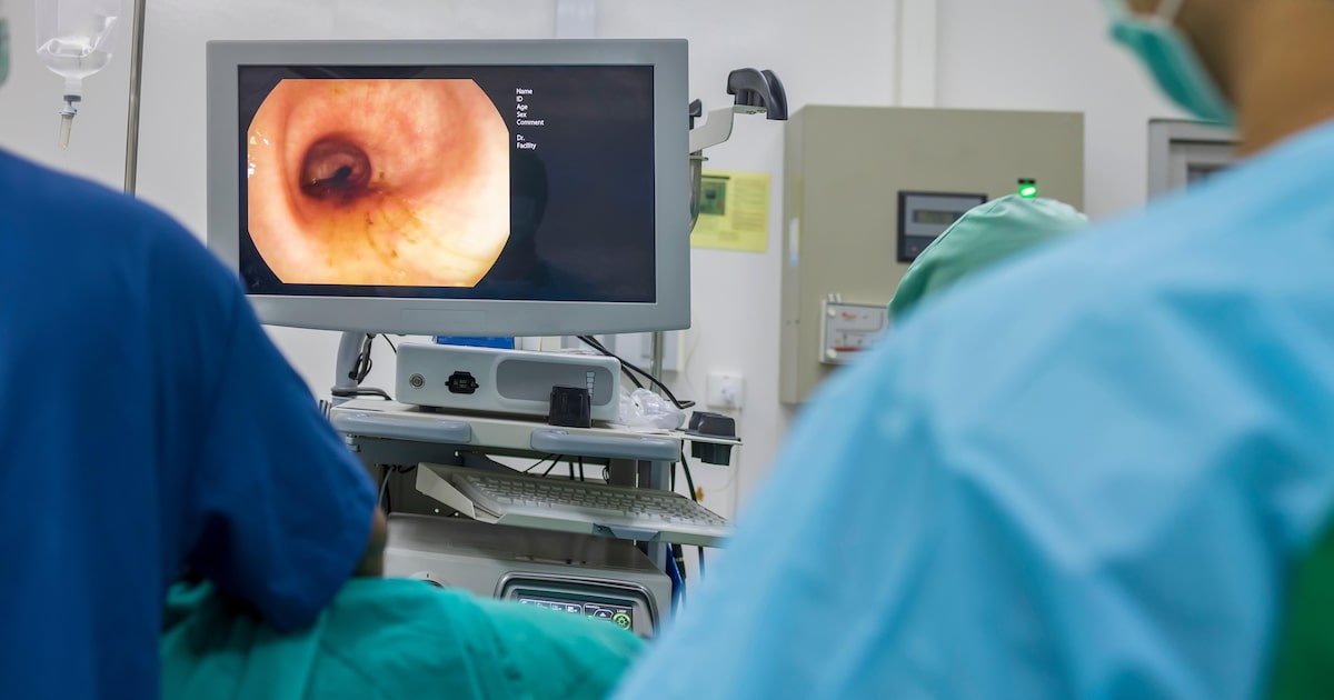 Apesar da alta de mortes, País ainda não tem programa de rastreamento para câncer de intestino