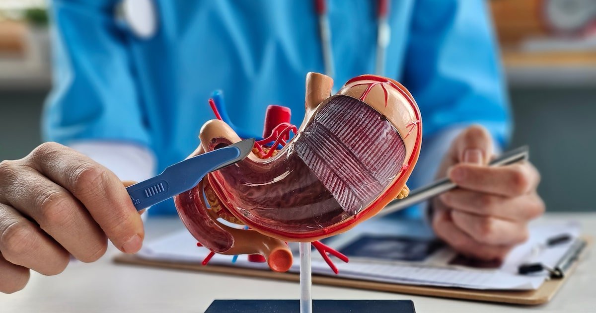 Cirurgia bariátrica em adolescentes ainda é rara no SUS, mesmo com avanço da obesidade; entenda